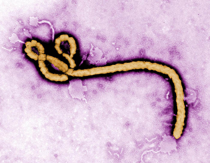 ebola-virus