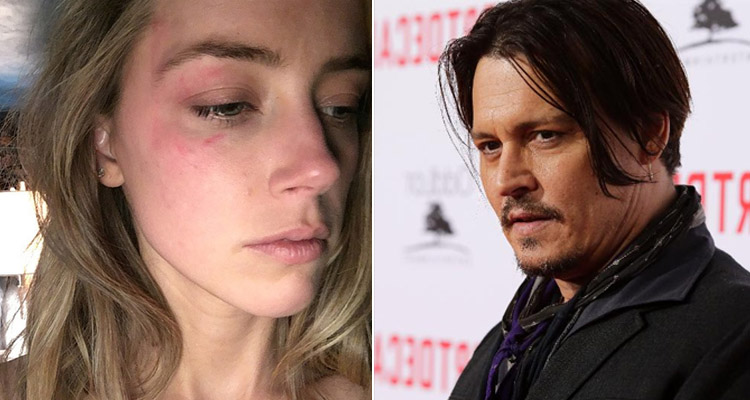 Amber Heard picchiata da Johnny Depp